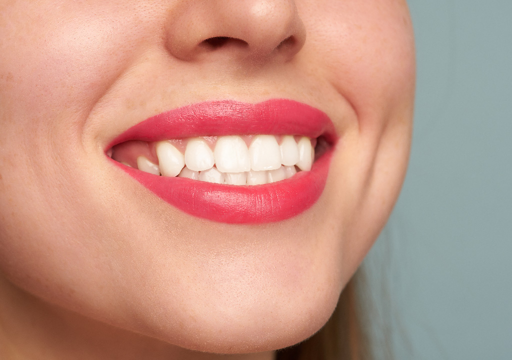 How to improve my smile with tooth veneers Treatment, In Arden, NC