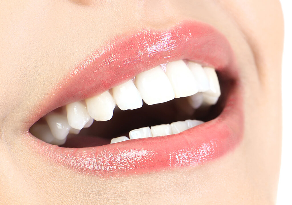Professional Teeth Whitening Dentist Arden in North Carolina Area